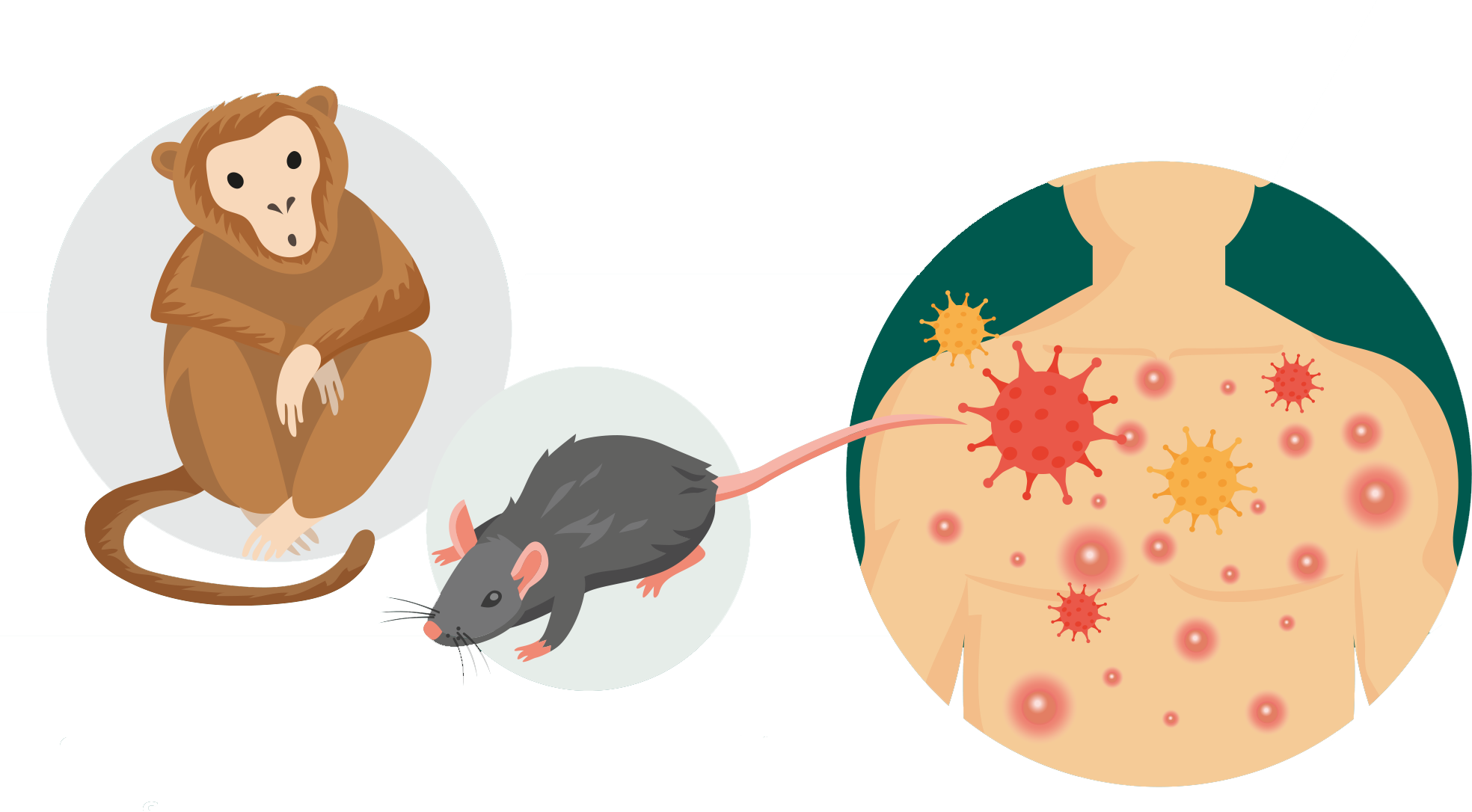 MPOX